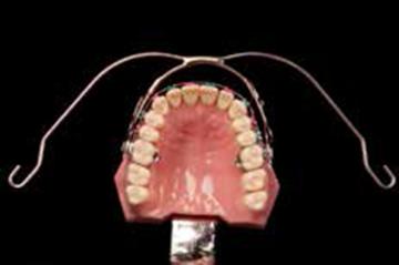 Aparat extraoral