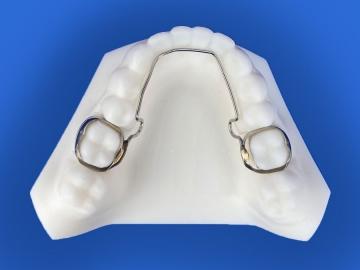 Arc transpalatinal / Arc lingual