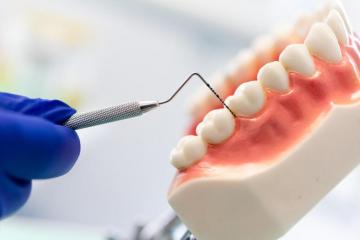 parodontologie, boala parodontala, gingivita, parodontita, tratament parodontal, dentist, sanatate orala