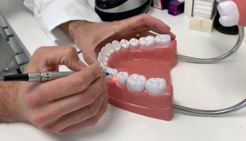 tratament laser stomatologie, tratament fara durere dinti carii, pret consultatie stomatologie