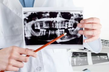 consultatii stomatologie Bucuresti, medic stomatolog consultatie preturi