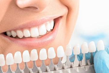 Estetica dentara