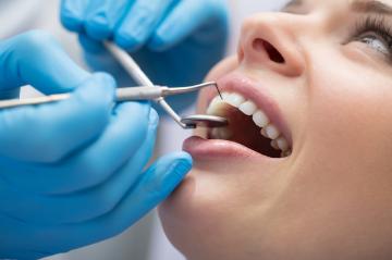 fatete dentare pret, punti dentare medic stomatolog preturi