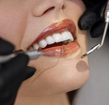 fatete dentare pret, punti dentare medic stomatolog preturi