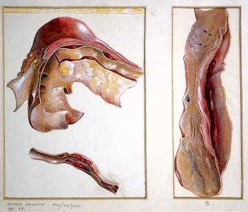 cabinete medicale anatomie patologica pret, oferte anatomei patologica preturi, clinica medicala anatomei patologica medici buni