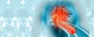 medic cardiolog coronarografie, pret coronarografic, medic cardiolog bun cardiologie interventionala, pret angiografie clinica, preturi angioplastie