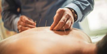 sedinte acupunctura pret, clinica medicala acupunctura, servicii acupunctura china preturi