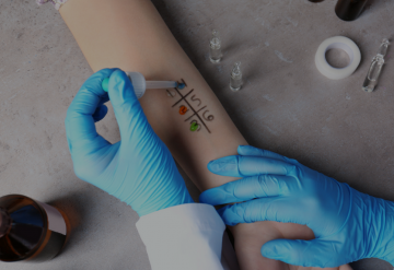 spital alergologie programare, pret consult alergologie, pret test alergologic, teste imunologice preturi